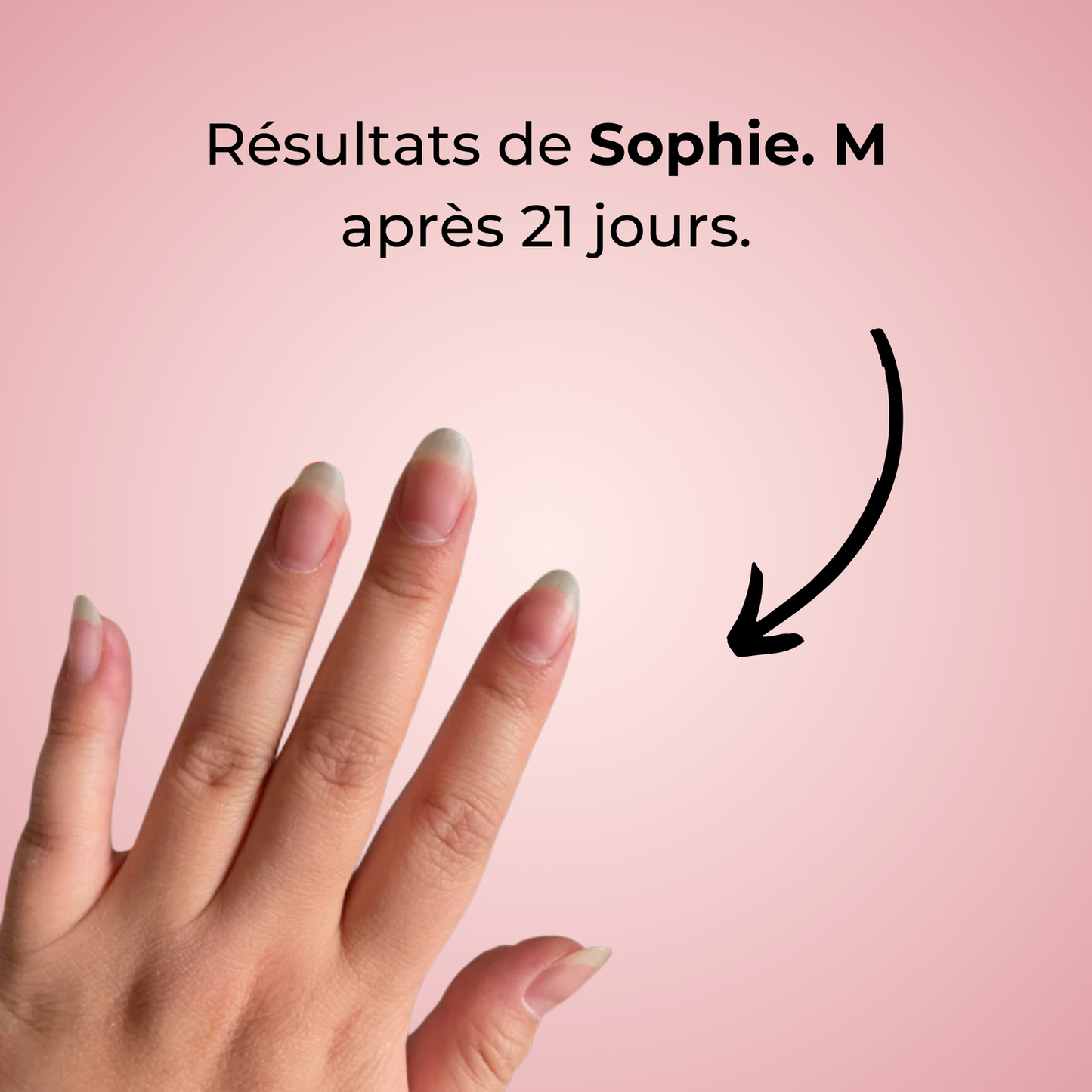 alluma. | Sérum de Croissance des Ongles (1 Acheté = 1 OFFERT)
