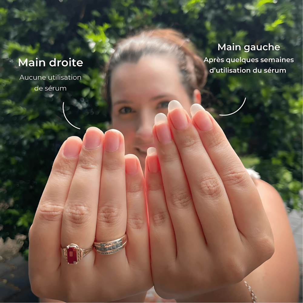 alluma. | Sérum de Croissance des Ongles (1 Acheté = 1 OFFERT)